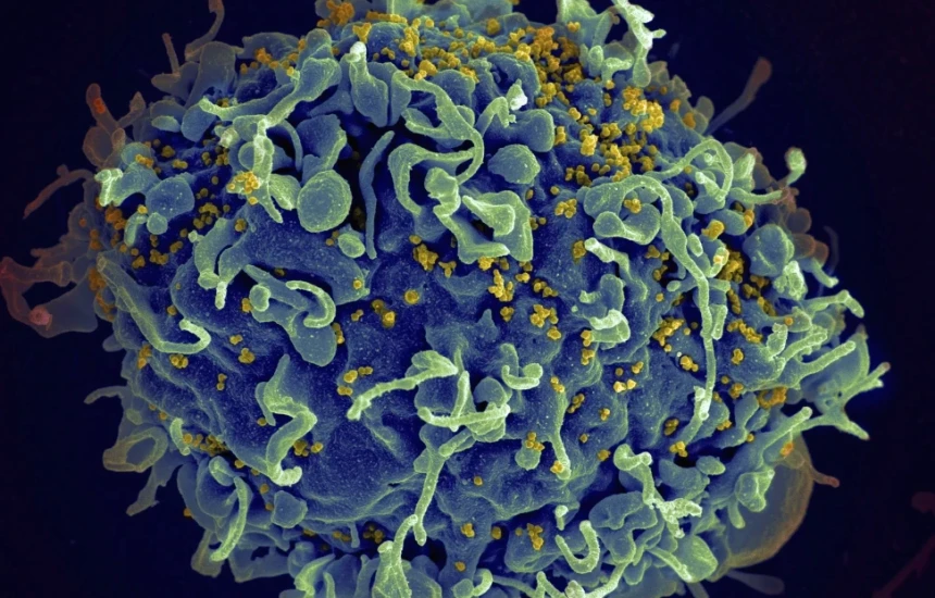 okb rreth 40 milione njerez te infektuar me hiv gjate 2023