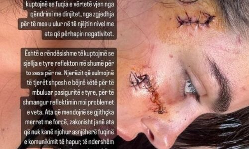 dyshohet se e dhunuan pasi i mori bashkeshortin marinela berishes klea prenga e mohon ajo ska burre nuk i kam nderhyre ne familje